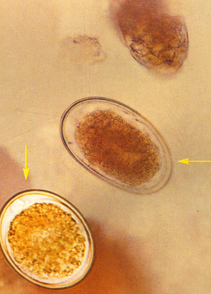 脱蛋白质膜蛔虫卵图片